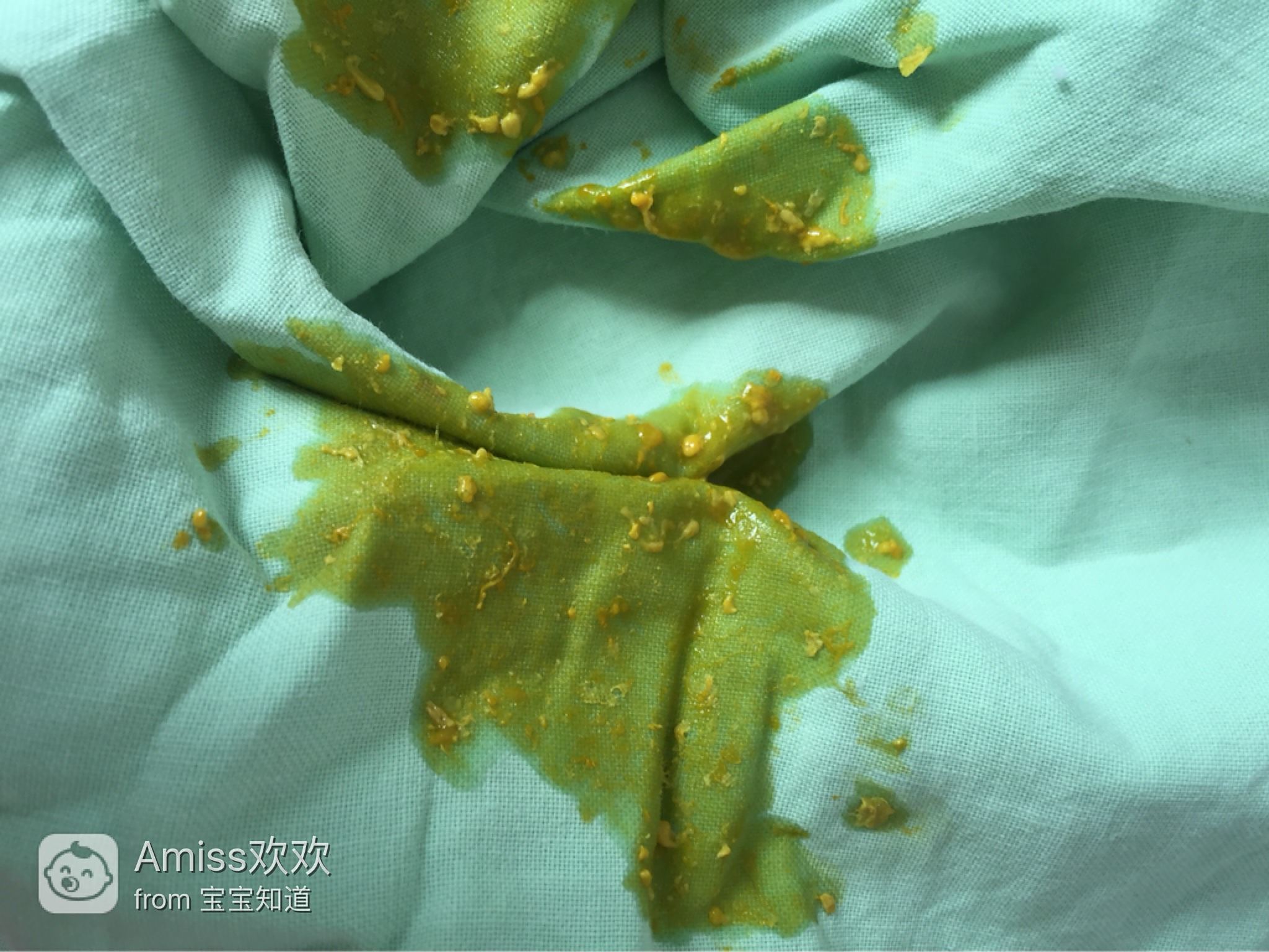 十來天的嬰兒老是拉稀怎么辦？全面解析寶寶腹瀉應(yīng)對之策，嬰兒腹瀉應(yīng)對指南，全面解析寶寶拉稀怎么辦？