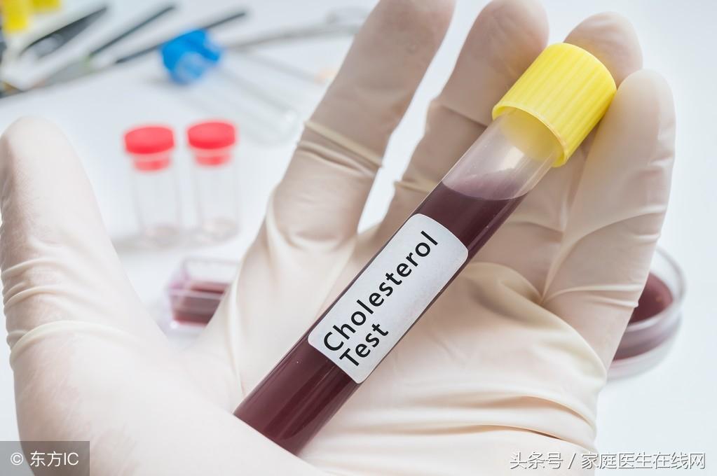 糖尿病的成因，深度解析其背后的原因，深度解析糖尿病成因，揭示背后原因真相