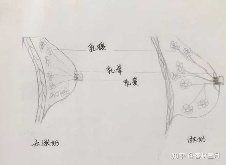 乳房硬塊消除，了解成因與應(yīng)對(duì)方法，乳房硬塊消除，成因解析與應(yīng)對(duì)方法指南