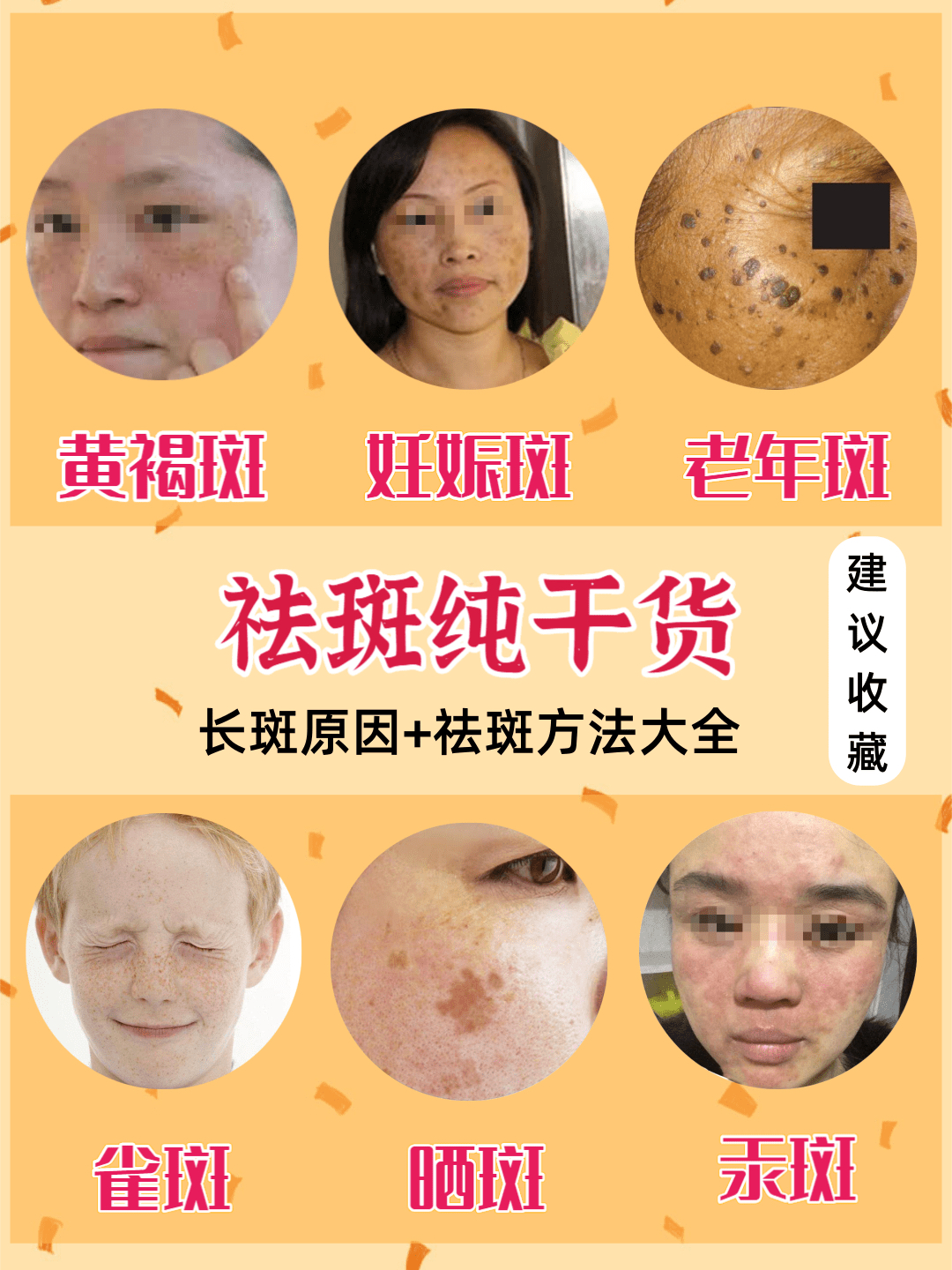 揭秘祛斑目前最有效的方法——打造無瑕肌膚，揭秘最有效的祛斑方法，打造完美無瑕肌膚