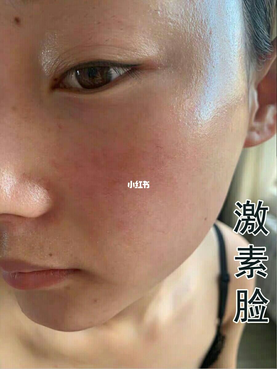 面部激素臉圖片及其相關(guān)問(wèn)題解析，面部激素臉圖片解析及相關(guān)問(wèn)題探討