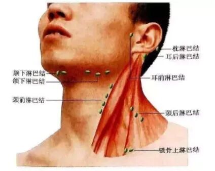 頸部淋巴結(jié)自檢手法，了解、預(yù)防與早期發(fā)現(xiàn)，頸部淋巴結(jié)自檢手法詳解，了解、預(yù)防與早期發(fā)現(xiàn)的重要性