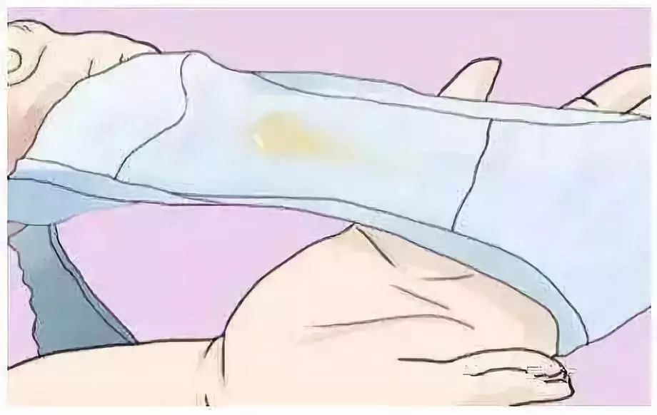 了解女性健康，白帶是什么樣子的圖片詳解，女性健康知識(shí)普及，白帶形態(tài)詳解及圖片介紹