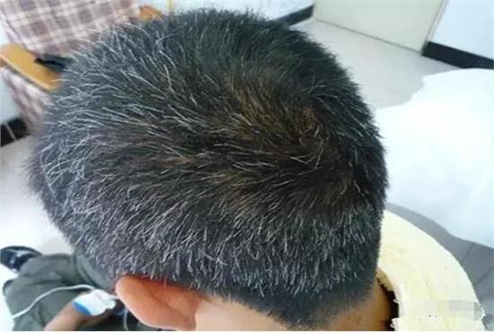 白發(fā)變黑發(fā)最好的土方法——自然黑發(fā)秘訣，自然黑發(fā)秘訣，白發(fā)變黑的土方法