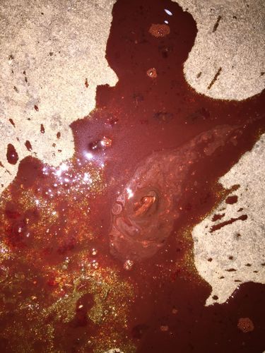 男性拉血是怎么回事？解讀便血現(xiàn)象及其原因，男性便血現(xiàn)象解析，原因及應(yīng)對方法