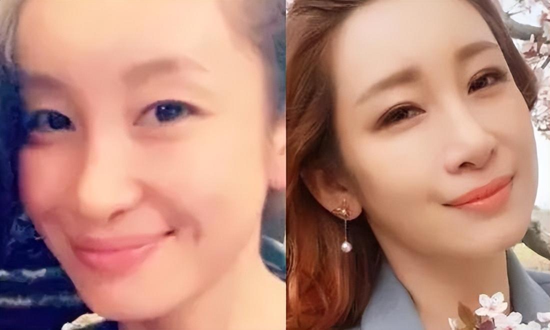 秦海璐割雙眼皮前后對比，揭秘變化之美，秦海璐雙眼皮變化揭秘，前后對比展現(xiàn)美的蛻變