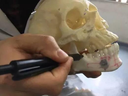 智齒的形態(tài)與圖片解析，了解牙齒生長的最后階段，智齒形態(tài)與圖片解析，探究牙齒生長最后階段的全貌