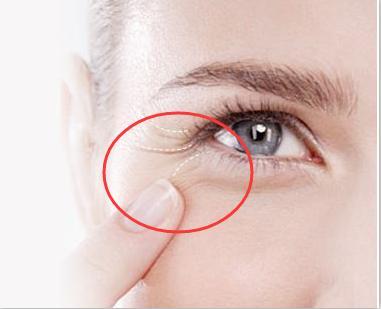 如何去除魚尾紋，最佳方法與實(shí)用建議，去除魚尾紋，最佳方法與實(shí)用建議攻略