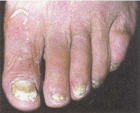 全面解析，100種皮膚病對照表圖片，100種皮膚病對照表圖片，全面解析皮膚病癥狀與類型