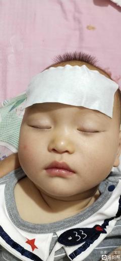 小孩子發(fā)燒39度怎么退燒最快？全面指南與關(guān)鍵措施，全面指南，兒童高燒39度快速退燒方法與關(guān)鍵措施