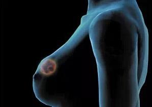 乳腺癌患者的生存期，了解與面對(duì)，乳腺癌患者的生存期，了解與面對(duì)的挑戰(zhàn)
