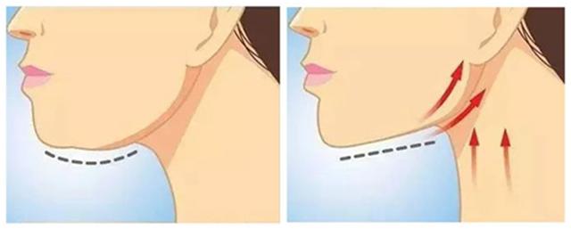 如何排出臉上的毒素——打造健康肌膚光彩，臉部排毒秘訣，打造健康肌膚光彩的秘訣